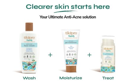Tikitoro Launches Teens Anti-Acne Kit to Empower Young Skin