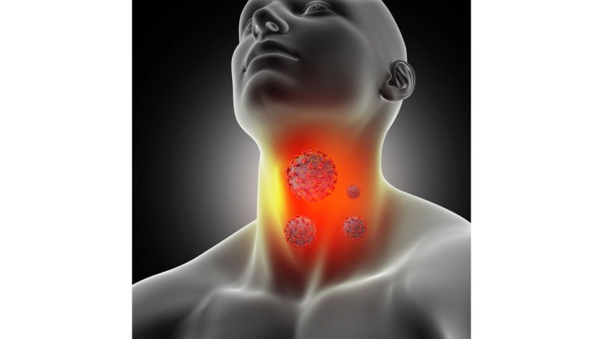 Early Signs and Symptoms of Thyroid Cancer You Should Not Ignore